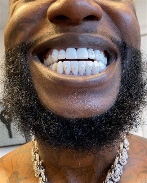 gucci gold teeth|Gucci mane diamond studs.